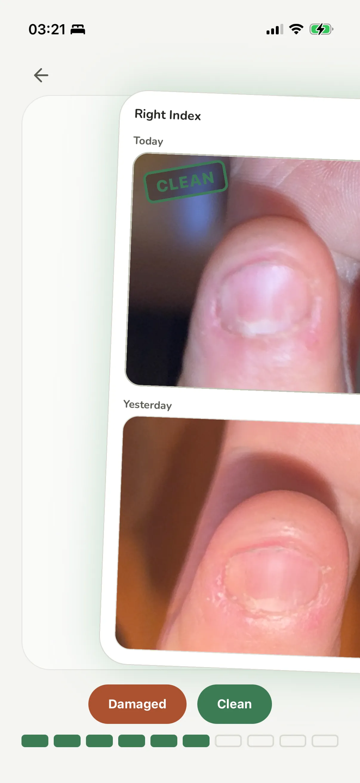 The compare deck: a photo of today's index fingernail above yesterday's, stamped clean, with damaged and clean buttons below.