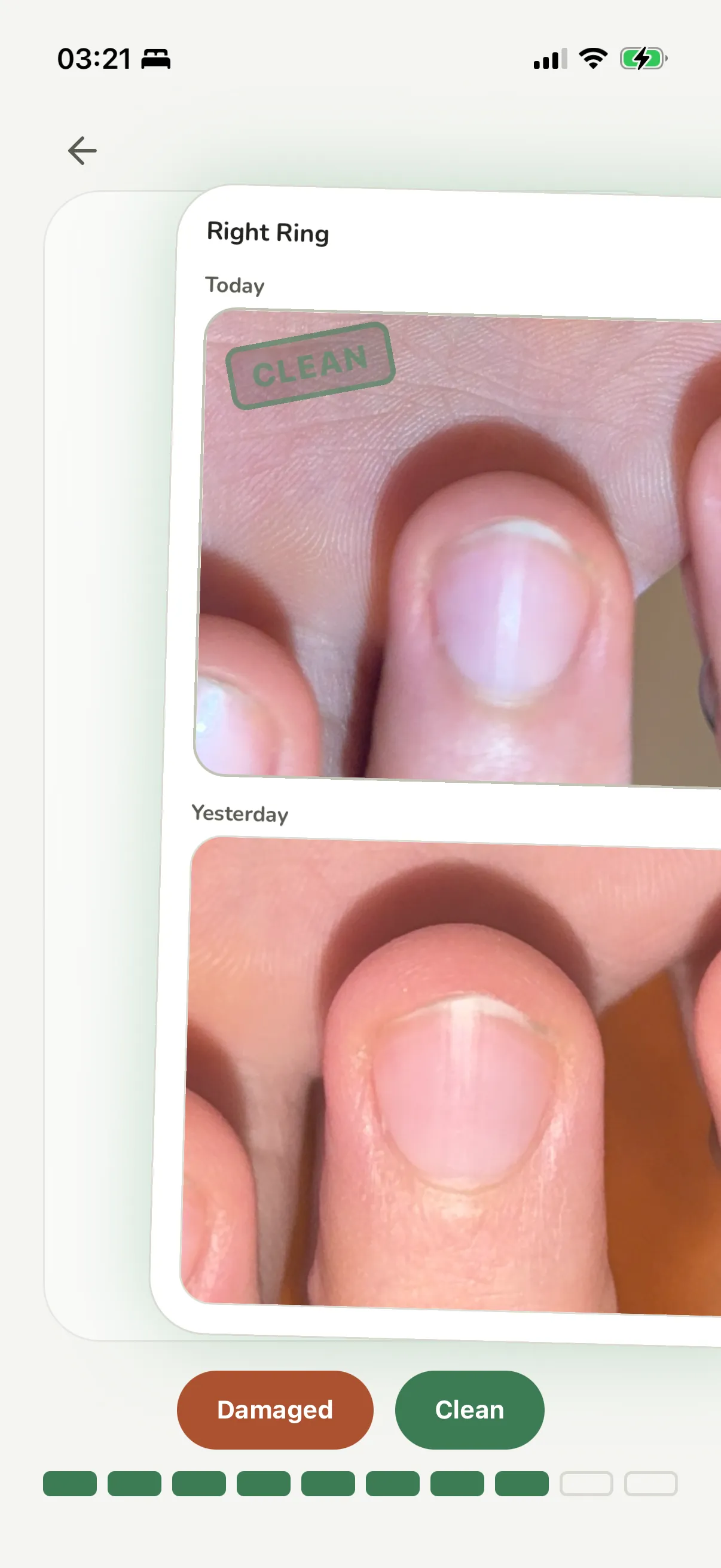 The nonyxa compare deck: a photo of today's ring fingernail above yesterday's, marked clean.